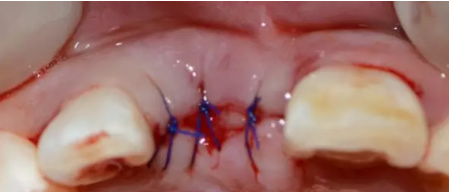 圖片5.png 圖片5.png