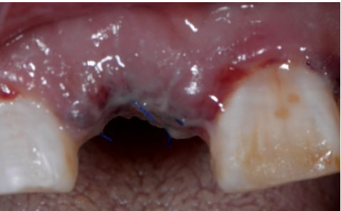 圖片6.png 圖片6.png